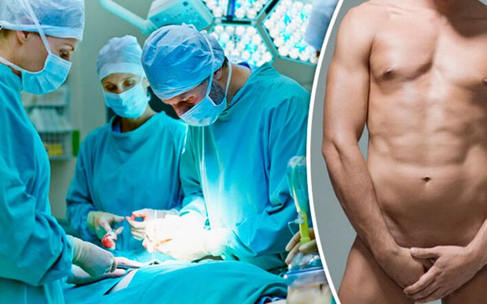 Aumento chirurgico nel pene